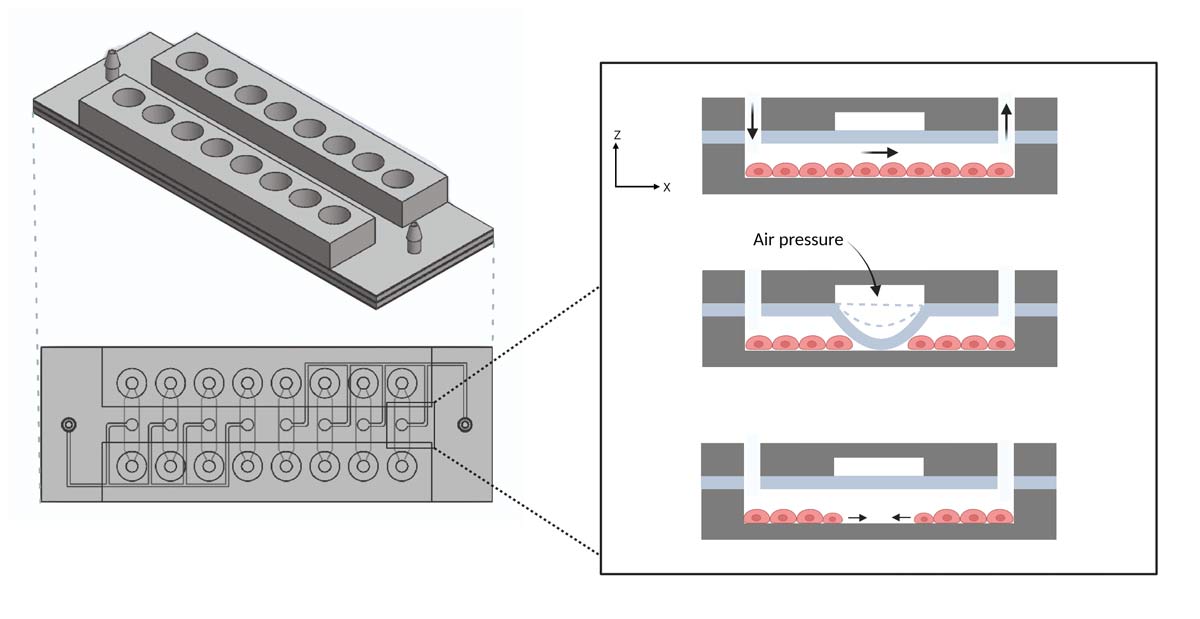 Comprevie - chip